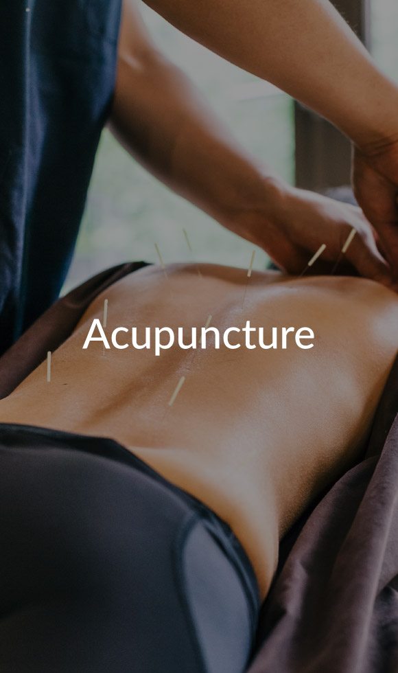 acupuncture at Natural Therapy Wellness Center in McHenry IL